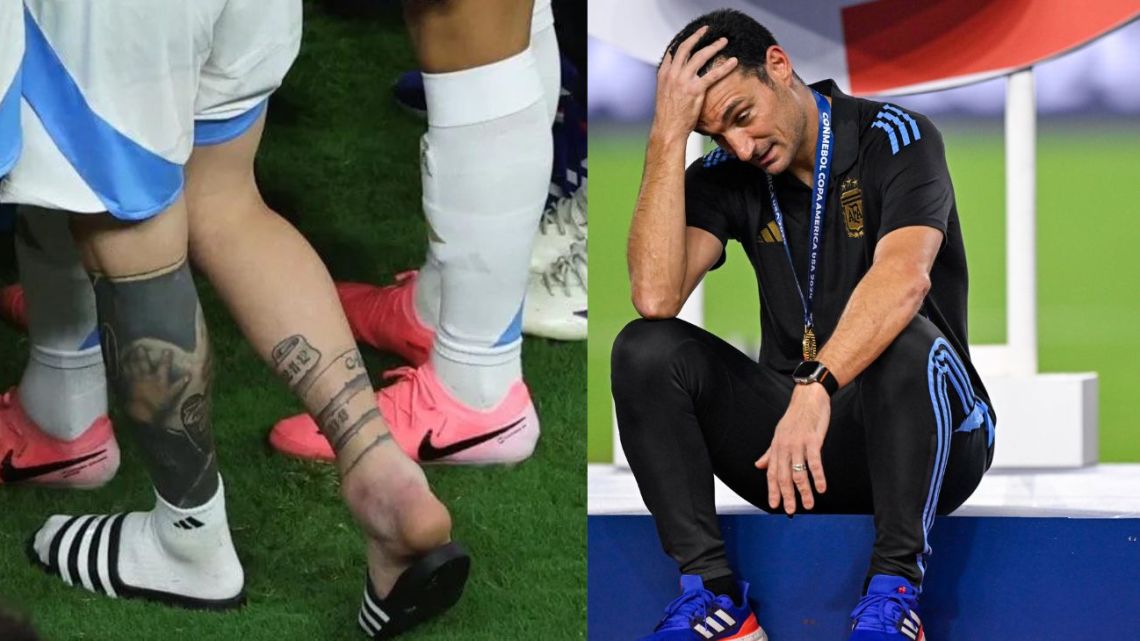 Scaloni habló sobre la lesión de Messi: "Tenía el tobillo a la miseria"