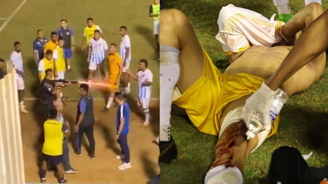 Locura en el Ascenso de Brasil: un policía le disparó a un jugador